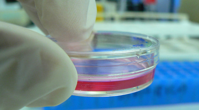 Computer vision saves lives